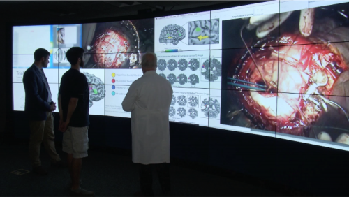 Brain mapping image
